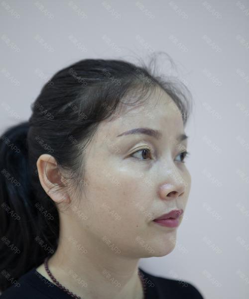 新氧美容（打造个性化美丽，让你焕发自信）